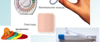 контрацепция после родов