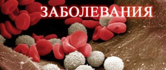 виды аутоиммунных заболеваний